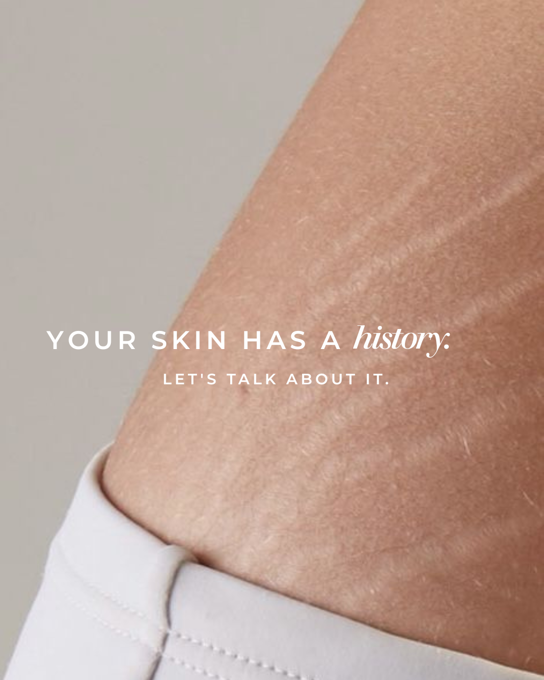 Scarring & Stretch Marks: Understanding Your Skin and Your Treatment Options